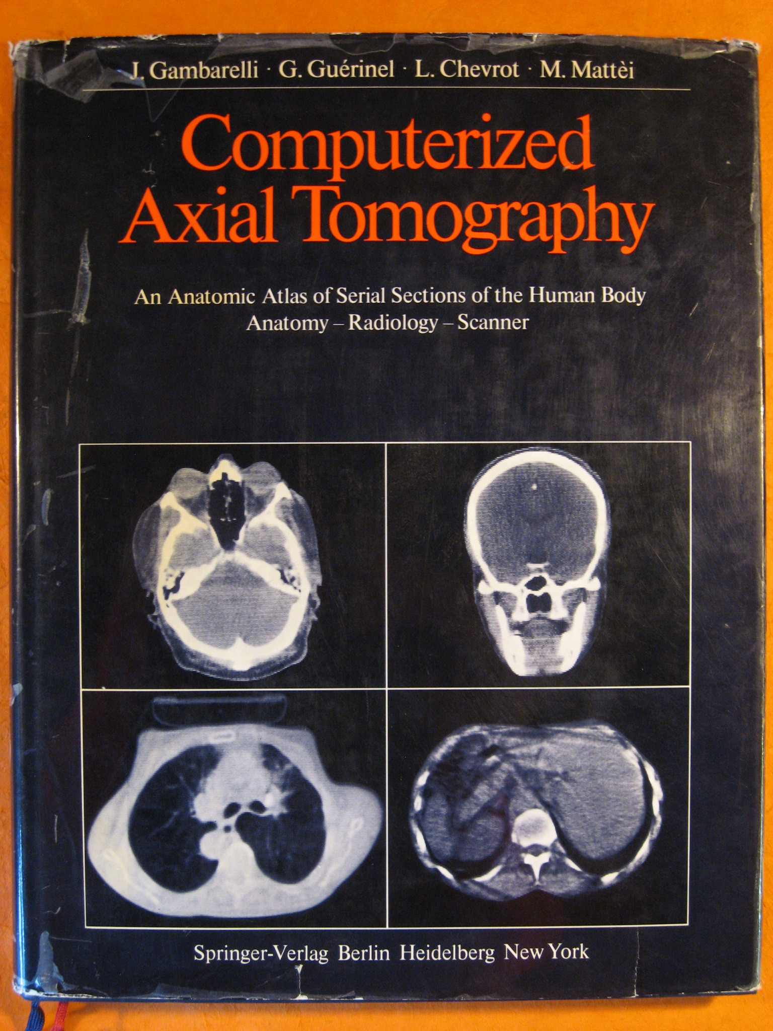 Image for Computerized Axial Tomography: An Anatomic Atlas of Serial Sections of the Human Body. Anatomy, Radiology, Scanner
